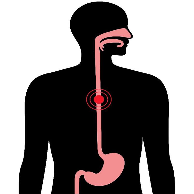 Dysphagia Awareness